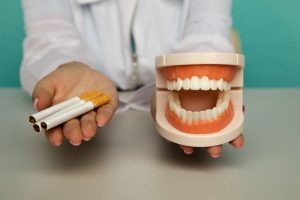 Scopri di più sull'articolo Fumo e implantologia dentale: come il tabagismo influisce  sulla riuscita degli impianti dentali