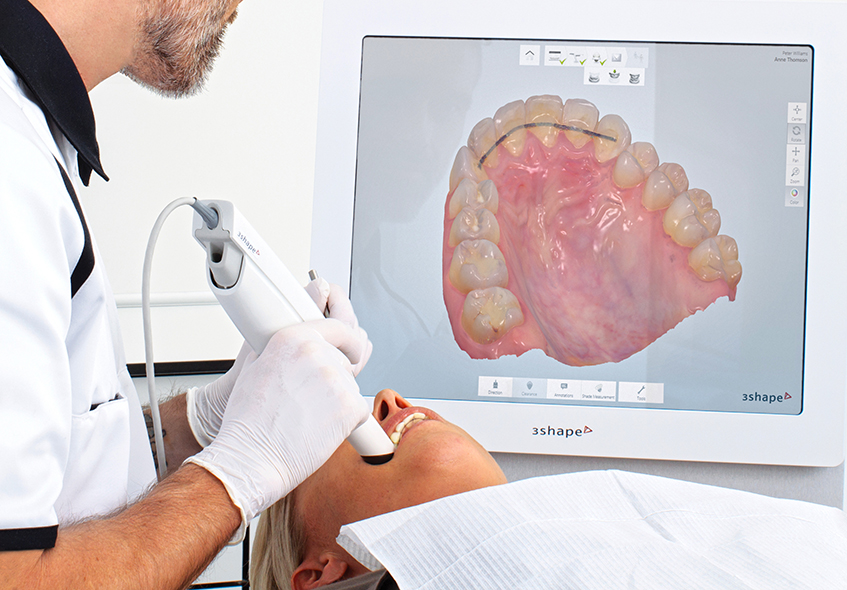 Scopri di più sull'articolo Lo scanner dentale: come funziona e quali sono i vantaggi